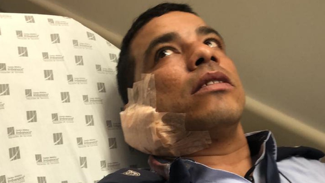 Guarda de Tránsito es herido en Cali en una oreja, durante un operativo