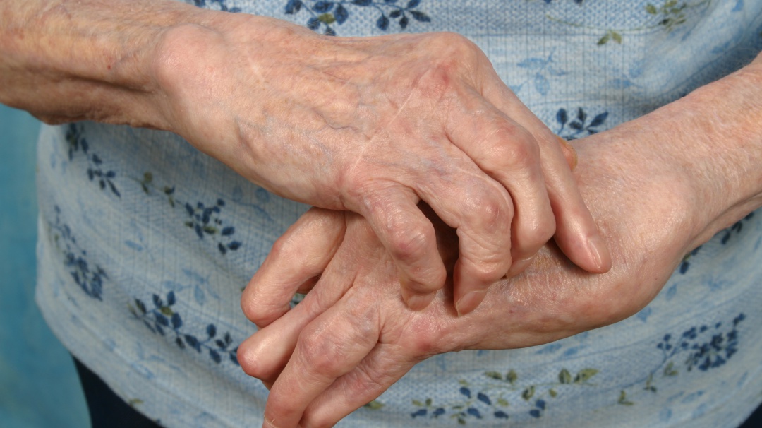 ¡Inhumano! En redes sociales denuncian maltrato a anciana de 80 años
