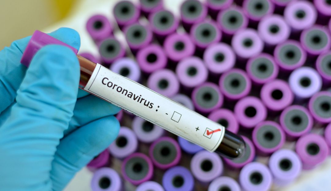 Coronavirus qué es: Lo que debe saber sobre el Coronavirus
