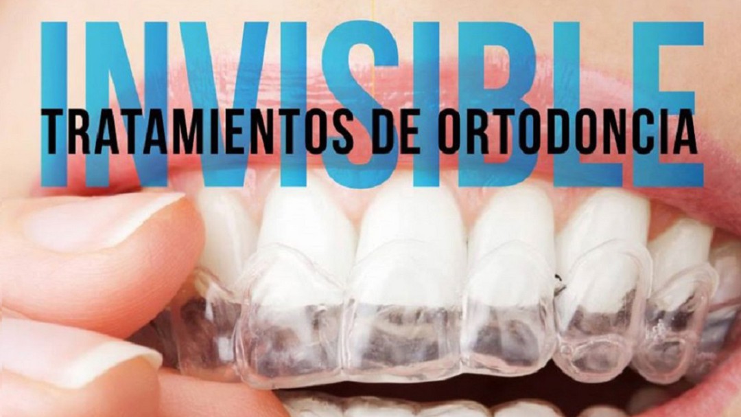 Ortodoncia invisible: un innovador proceso en la estética dental
