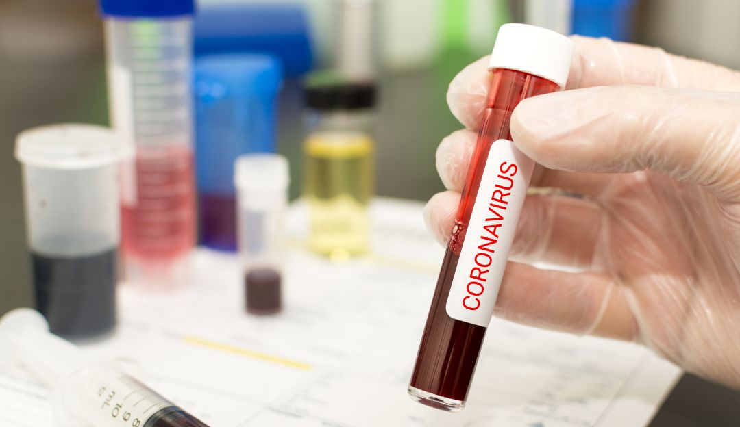 Coronavirus: Gobierno destina $15.000 millones para prevención contra el Coronavirus