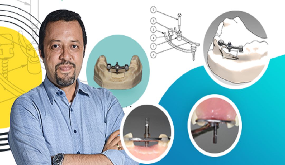 Tecnología para la salud oral: Docentes universitarios desarrollan tecnología que renueva sonrisas