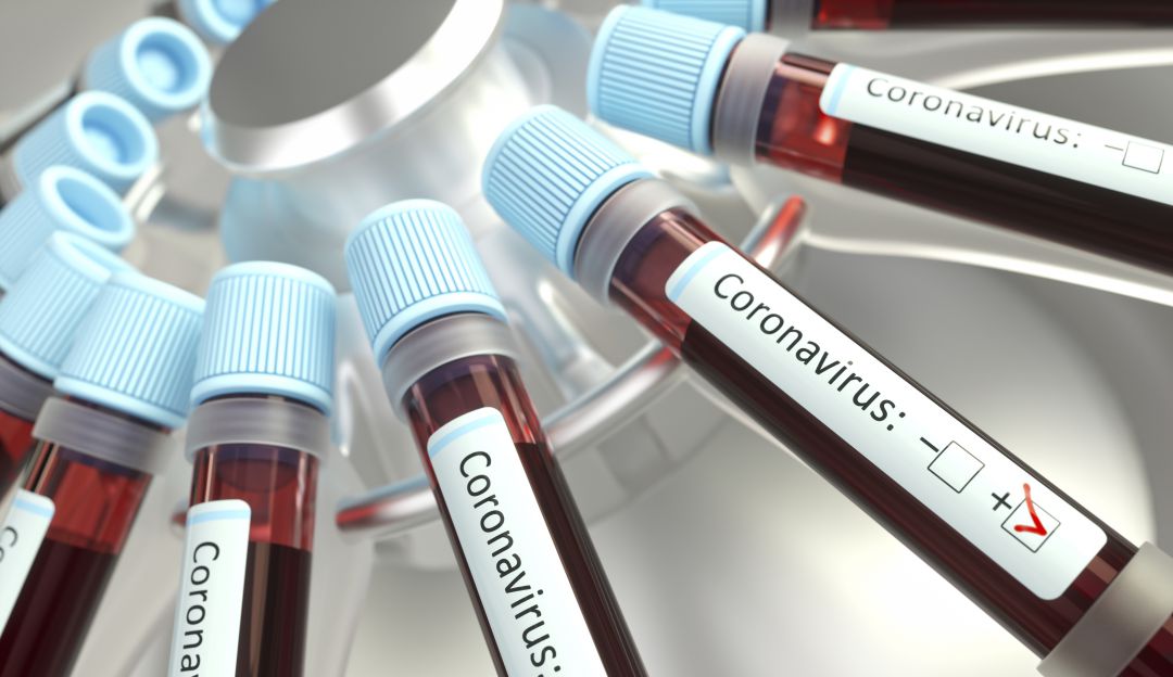 Coronavirus en América: Nueva York confirma primer caso de Coronavirus