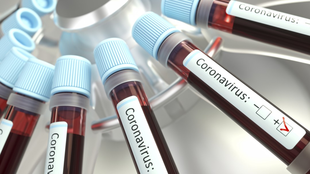 Nueva York confirma primer caso de Coronavirus