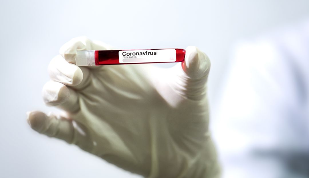 Coronavirus: Coronavirus superó las 3.000 muertes y frena la economía mundial