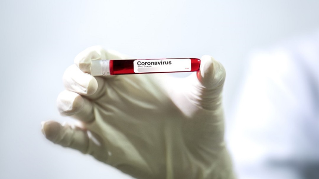 Desmienten supuesto caso de coronavirus en Barranquilla