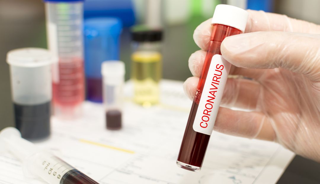 Coronavirus en Colombia: Colombia dispondrá de otros 5 laboratorios para detectar Covid-19