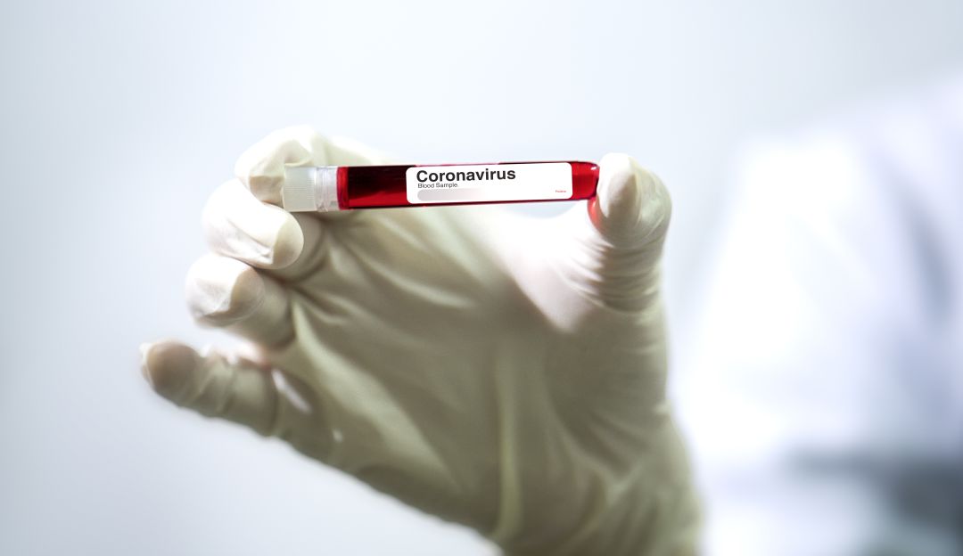 Coronavirus en América del sur: Perú confirma su primer caso de coronavirus