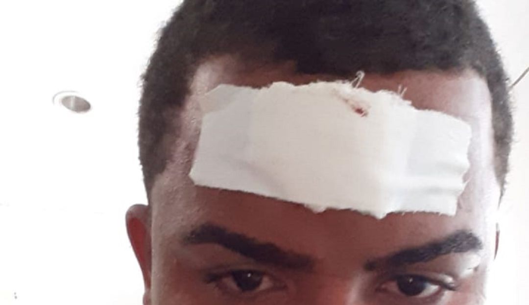 Agresiones a líderes sociales en Cartagena: Mujer y líder social fueron agredidos en un corregimiento de Cartagena