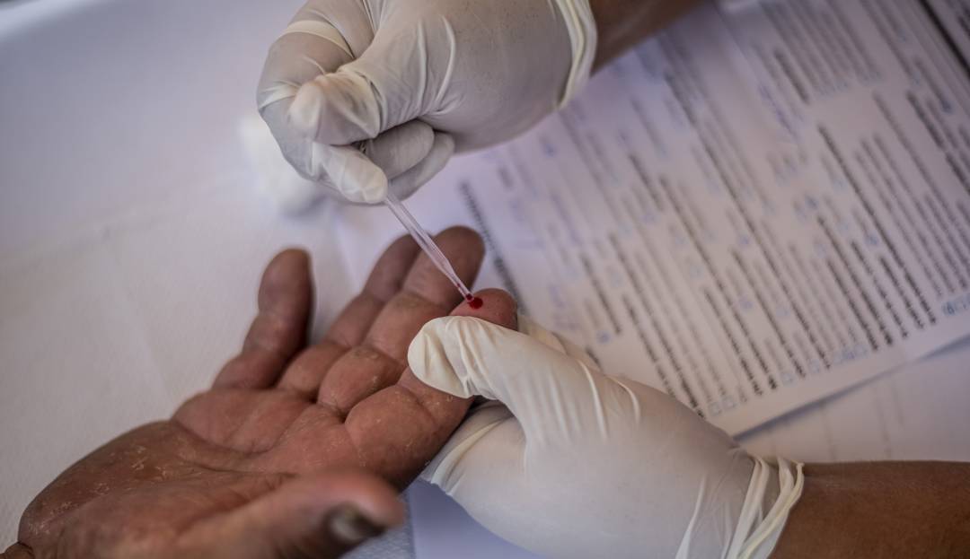Segundo caso mundial SIDA: Segundo caso mundial de curación de un paciente con el virus del sida