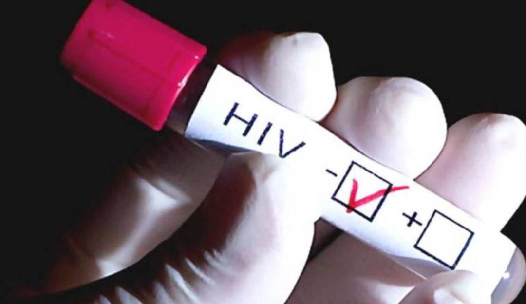 Los hombres los más afectados por el virus del VIH en el Huila