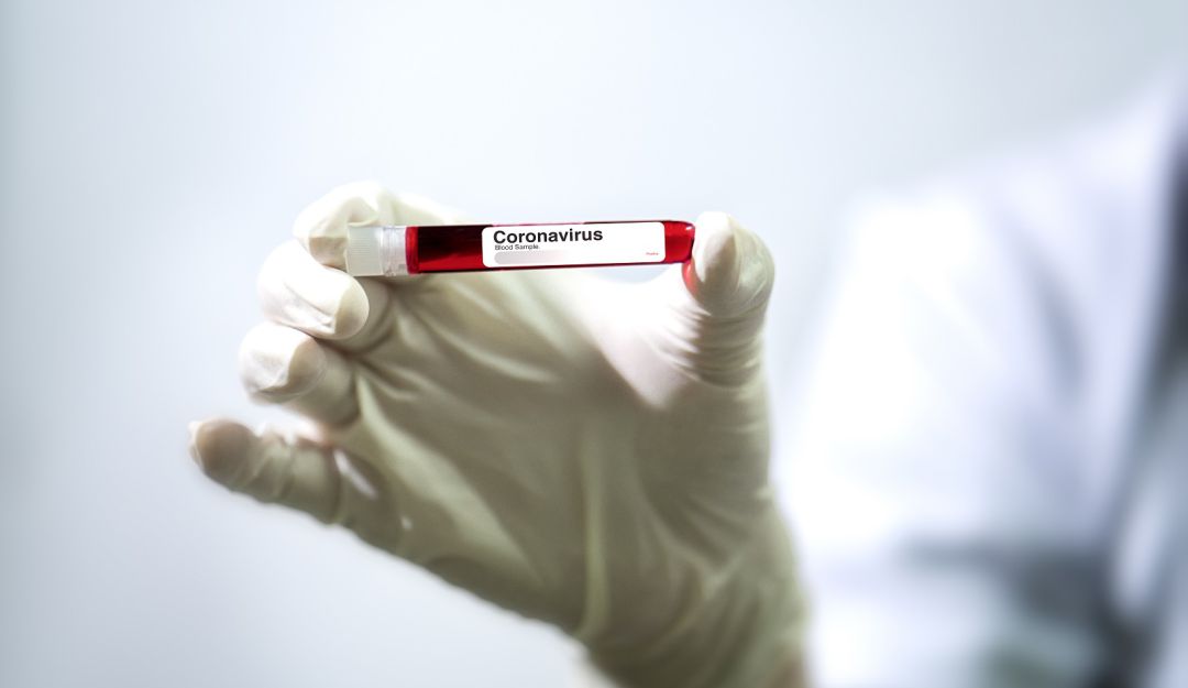 Coronavirus en Colombia: Dos casos de COVID-19 en Neiva