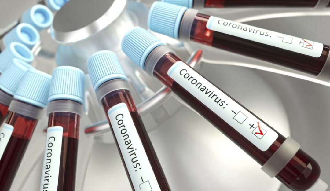 Noticias Colombia: Dos casos confirmados de coronavirus en Santa Marta: MinSalud confirma dos casos de Covid-19 en Santa Marta