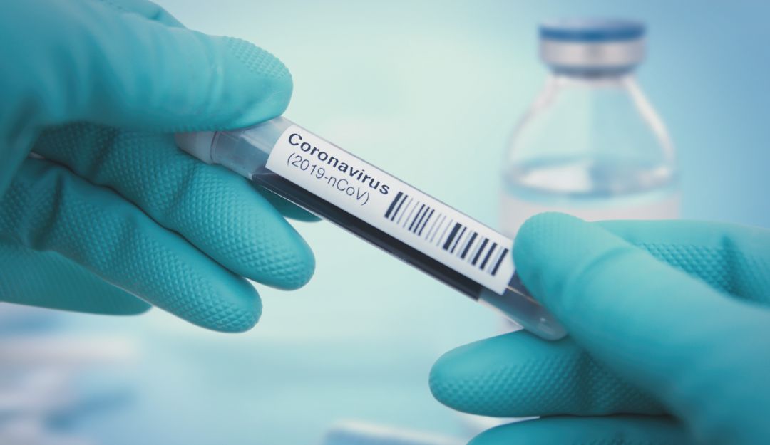Tests rápidos para detectar coronavirus: Conozca cómo son los ‘tests rápidos’ para detectar el coronavirus