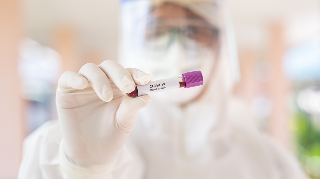 Multinacional habilita herramienta para conocer casos de coronavirus