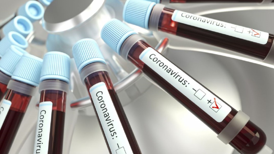 Asciende a 11 los casos de coronavirus en Valledupar