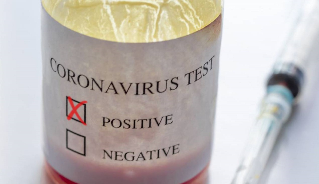 Universidad de Antioquia aisló el Virus Sars CoV – 2: Universidad de Antioquia aisló el Virus SARS-CoV-2