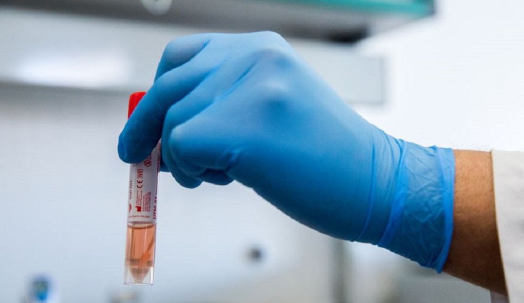 Salud, Coronavirus, Armenia, Quindío, Recuperados: Dos mujeres y un hombre primeros recuperados de COVID-19 en Quindío