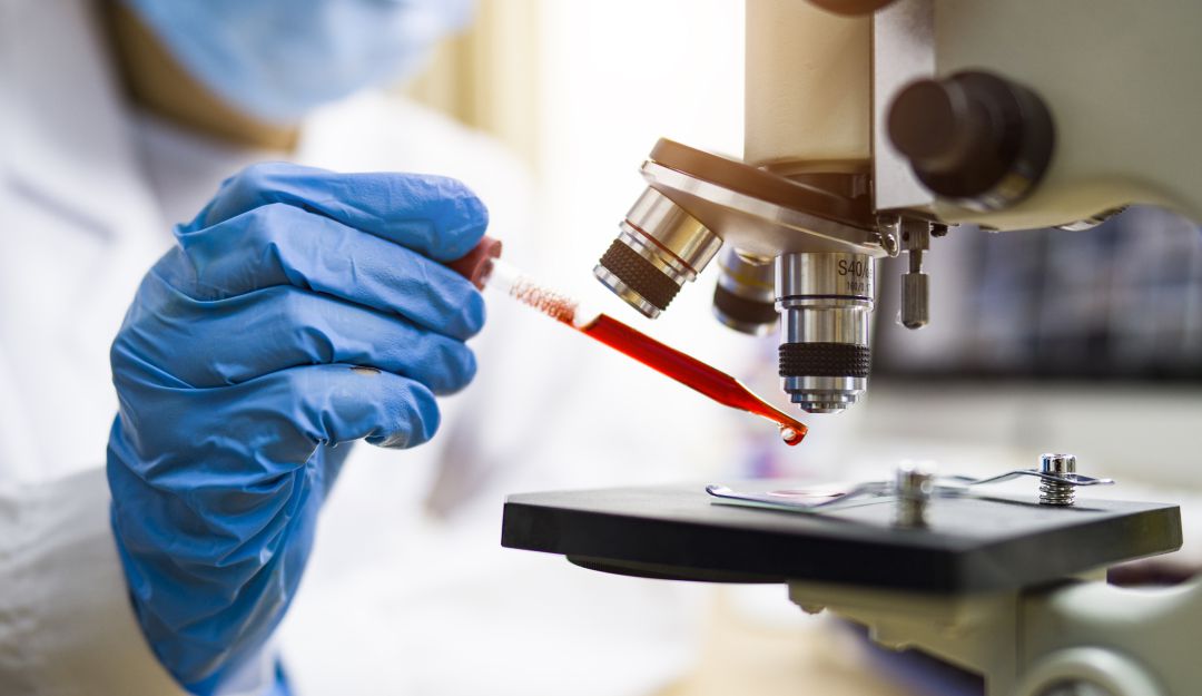Pruebas coronavirus en Colombia: Colombia superó su capacidad de análisis de muestras de covid-19Colombia su
