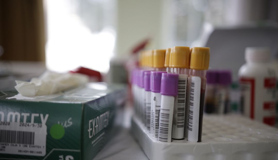 Pruebas coronavirus, Instituto Nacional de Salud: Cantidad de pruebas superó capacidad del INS