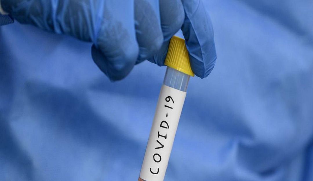 CORONAVIRUS: 11 nuevos contagiados: Galapa, Santo Tomás y Ponedera reportan primer caso
