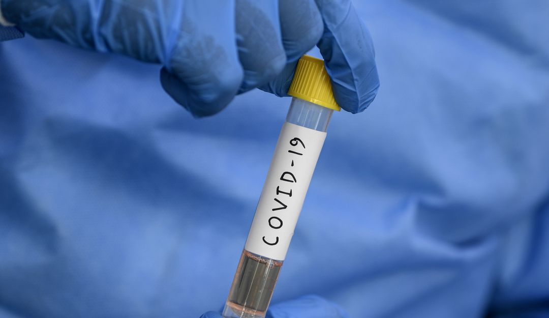 Covid 19 productos Superindustria: Ordenan retirar productos que ofrecen beneficios contra Covid-19
