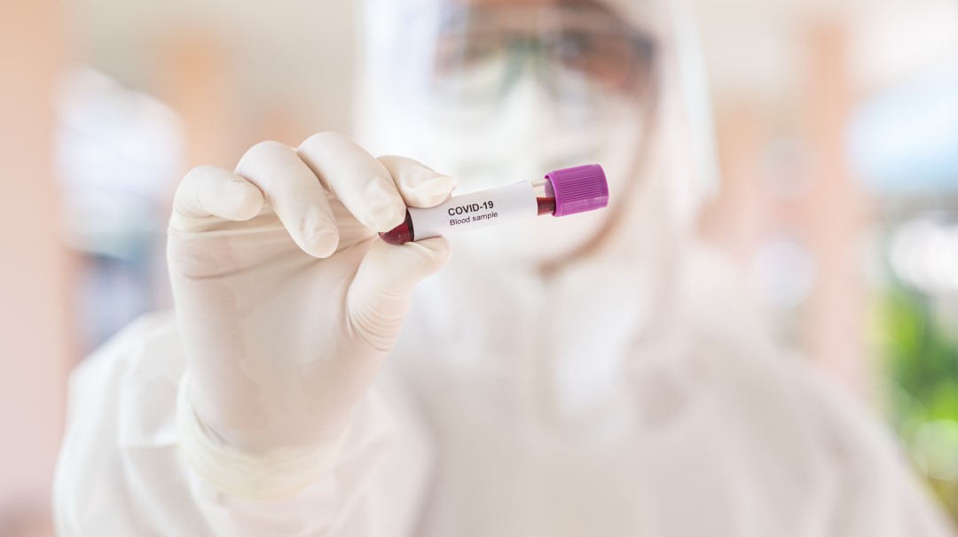 La OMS pide "poner en cuarentena" los intentos de politizar el coronavirus