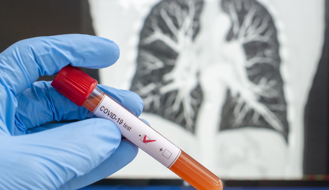 Coronavirus, Sincelejo: Familiares de la joven sincelejana con COVID-19 no están contagiados