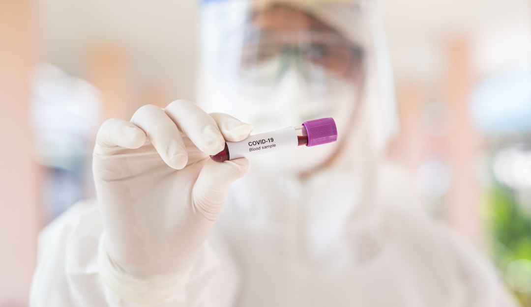 Coronavirus en Vaupés: Nuevos casos de COVID-19 en Mitú, Vaupés