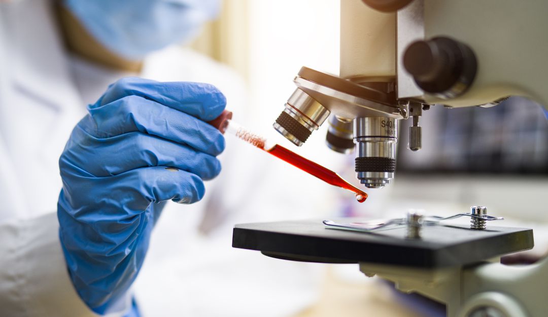 Coronavirus Chile: Chile hará exámenes masivos para detectar pacientes con coronavirus