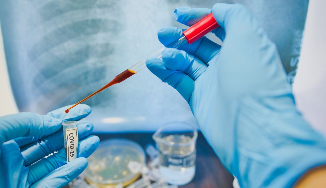 Coronavirus COVID-19: Respuesta de Colombia al COVID-19 entre mejores de Latinoamérica