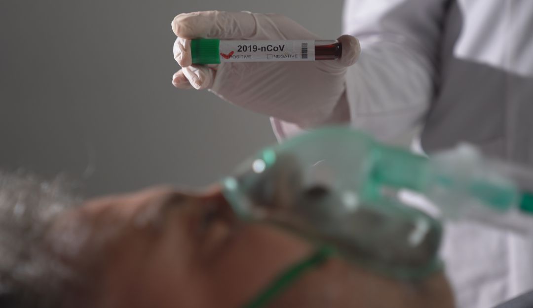 Coronavirus Covid-19: Acostar boca bajo a los casos graves de COVID-19 puede mejorar su condición