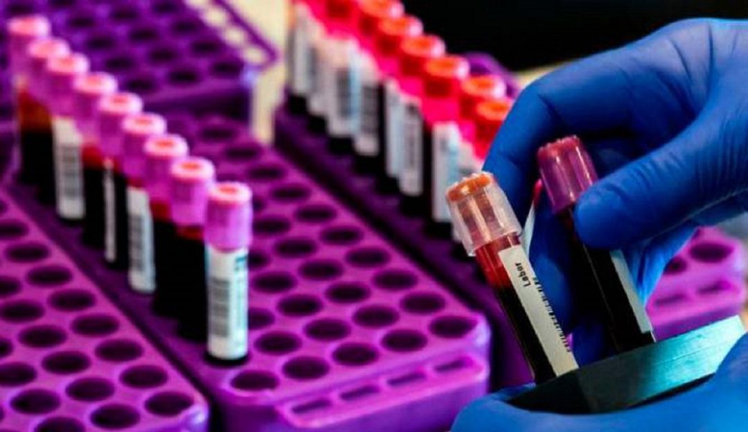 Bucaramanga salud coronavirus COVID-19 recuperados Santander: Tres nuevos casos de COVID-19 en Santander