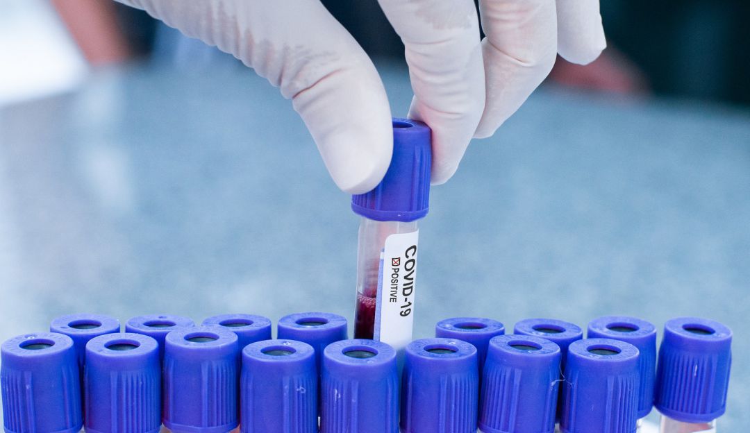 Coronavirus Covid-19: INS dice que se realizará búsqueda activa a 100.000 personas en el país