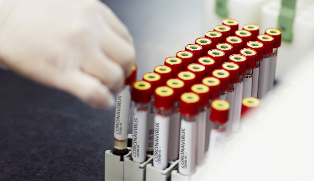 Coronavirus Covid-19: Colombia tiene 37 laboratorios habilitados para diagnóstico de coronavirus