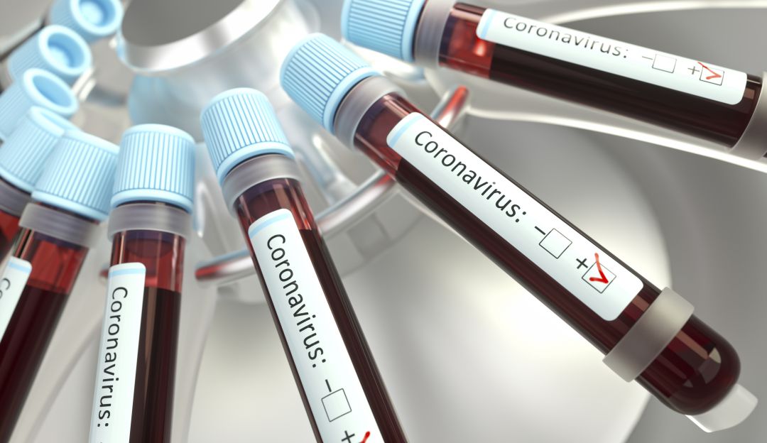 Coronavirus Colombia: Este es el cronograma de llegada de los ventiladores mecánicos a Colombia