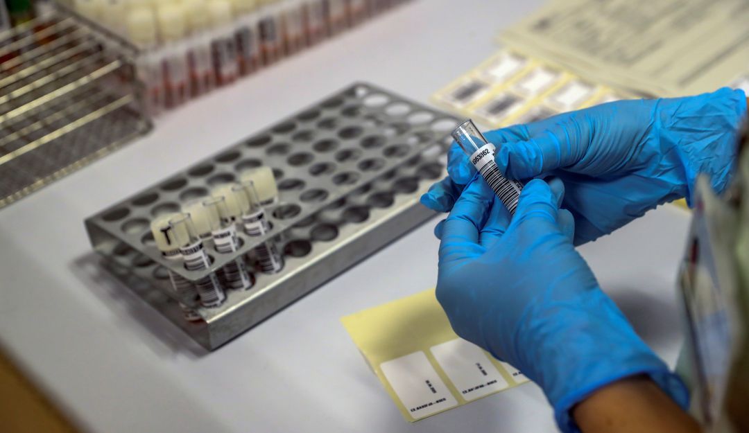 Israel desarrolla anticuerpo covid-19: Israel desarrolla un anticuerpo para el coronavirus