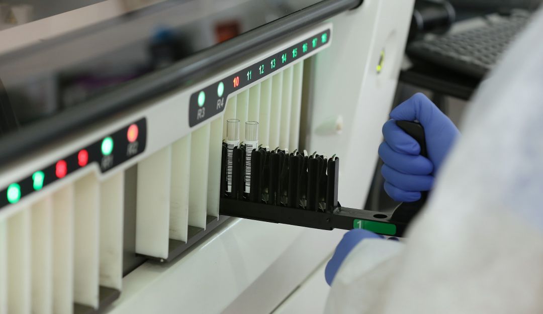 Confirman dos nuevos casos positivos de coronavirus en Sucre