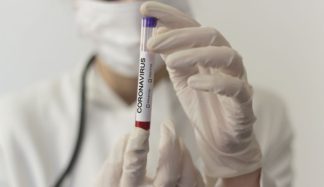 Casos coronavirus en Guaviare: La Alcaldía de Granada, Meta, reporta una persona del Guaviare con COVID-19