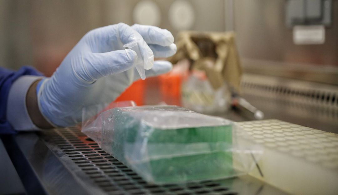 Cisneros reportó su primer caso de Coronavirus: Cisneros reportó su primer caso de Coronavirus