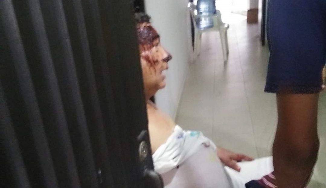 En Santa Marta, asaltantes golpean a sacerdote para robar en su casa