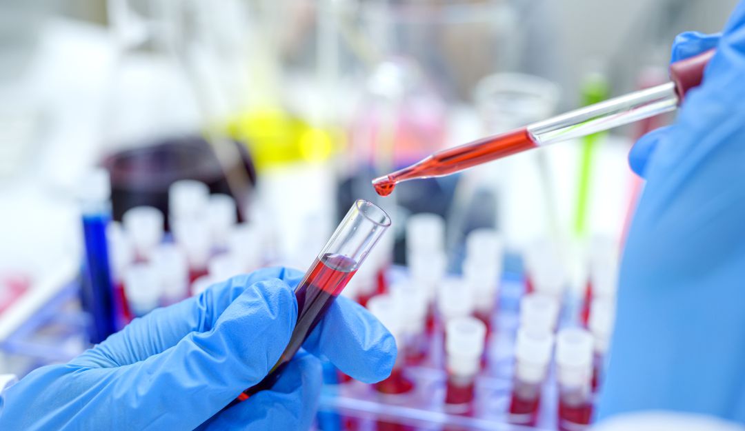 Plasma ensayos clínicos: Invima alerta sobre ensayos clínicos con plasma no autorizados