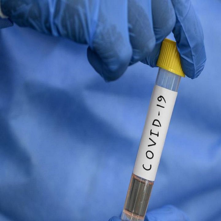 91 nuevos contagios con COVID- 19 en el Atlántico y 3 víctimas