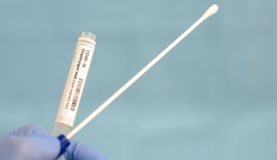 COVID-19 en Latinoamérica: Pandemia avanza en Latinoamérica y hay que apoyar a la región, dice la OMS