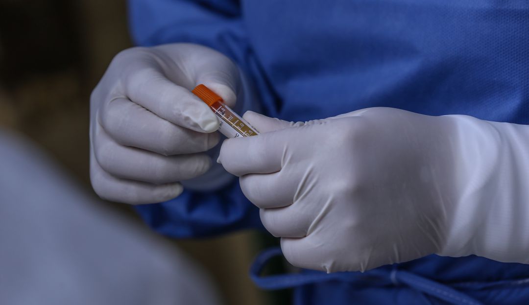 Reporte COVID-19: 28 nuevos fallecidos se reportan por coronavirus en el Atlántico