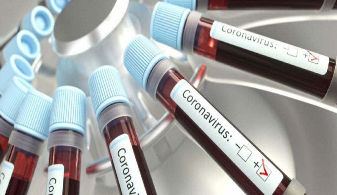 CORONAVIRUS: A dos suben casos de alcaldes contagiados con COVID- 19 en el Cesar