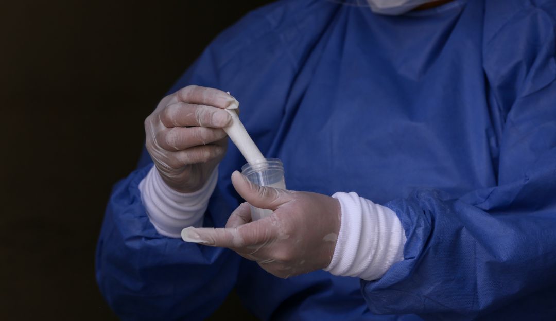 Casos de COVID-19 en Colombia: El Meta iniciará plan piloto con toma de muestras en pacientes asintomático