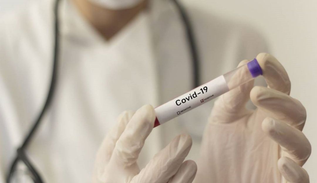 coronavirus en Arauca: 24 casos de Coronavirus en Arauca