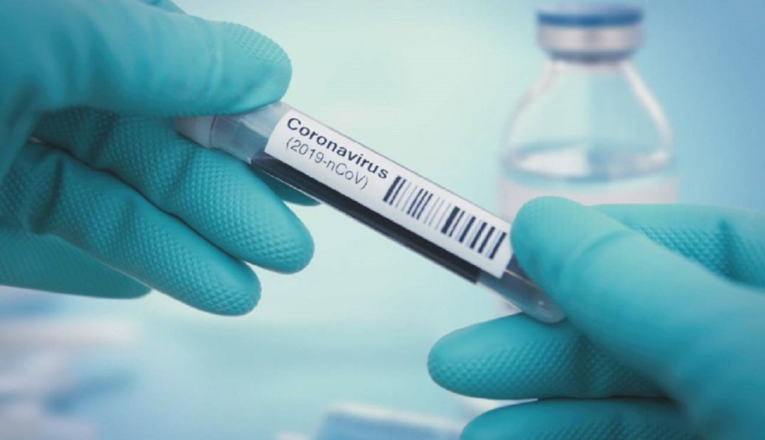 Crece cifra de contagios en Norte de Santander: Norte de Santander reporta 165 casos de Coronavirus