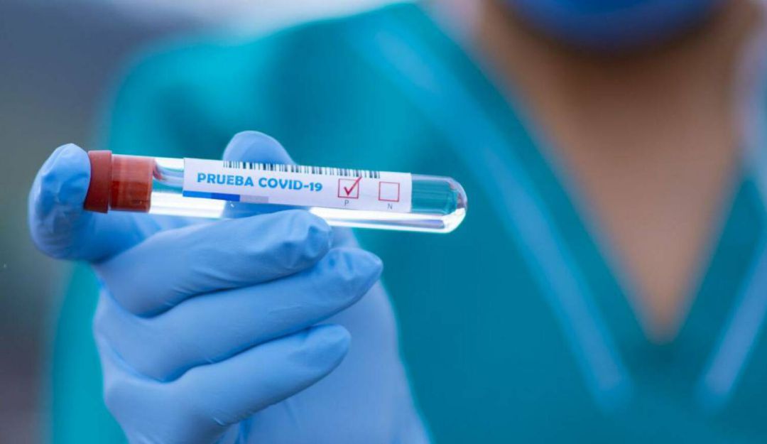 Nuevos casos de Coronavirus en Risaralda: Autoridades confirman 58 nuevos casos de COVID-19 en Risaralda